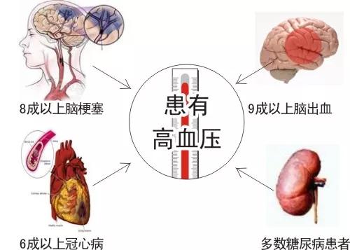 揭露“三高”真相:高血压、高血脂、高血糖