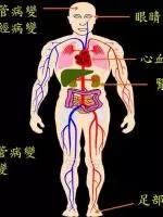 揭露“三高”真相:高血压、高血脂、高血糖