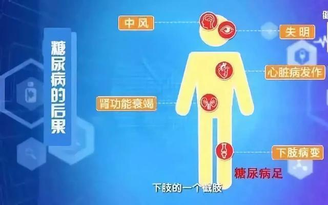 揭露“三高”真相:高血压、高血脂、高血糖