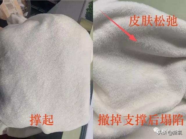 阿黛尔换人演了吗?200斤的体重减掉一半变纸片人,怎么做到的