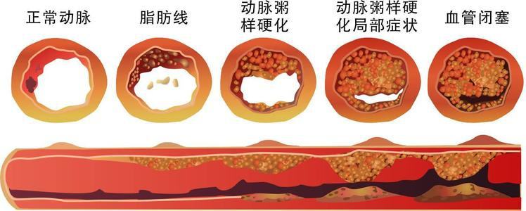 45-55岁,生命中的关键10年,做好4件事,延长寿命并不难