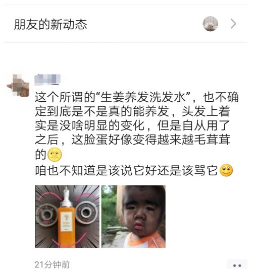 防脱干货,真实经历分享!如何战胜脱发,本文总结多种方法