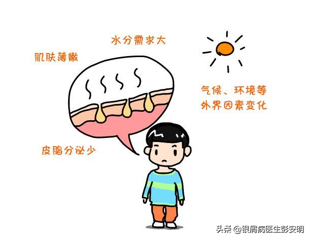 冬天是银屑病患者的克星?按照这6点来,这个冬天不难过