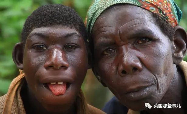 非洲男孩长相返祖只吃水果，被村民当"猴子"霸凌，让人心碎…